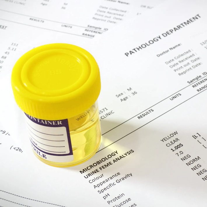 24h Urinalysis Interpretation Consultation | Devicare