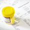 24h Urinalysis Interpretation Consultation and report | Devicare 24h Urinalysis Interpretation Consultation and report | Devicare