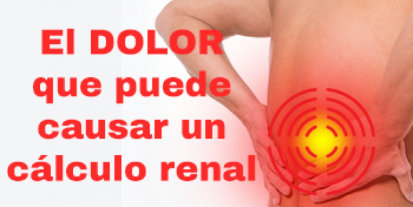 El dolor que puede causar un cálculo renal