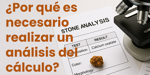 ¿Por qué es necesario realizar un análisis del cálculo?