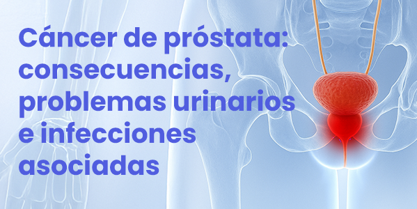 Cáncer de próstata: consecuencias, problemas urinarios e infecciones asociadas