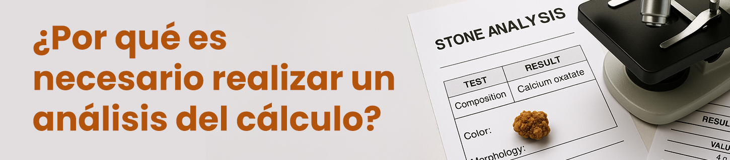 ¿Por qué es necesario realizar un análisis del cálculo?