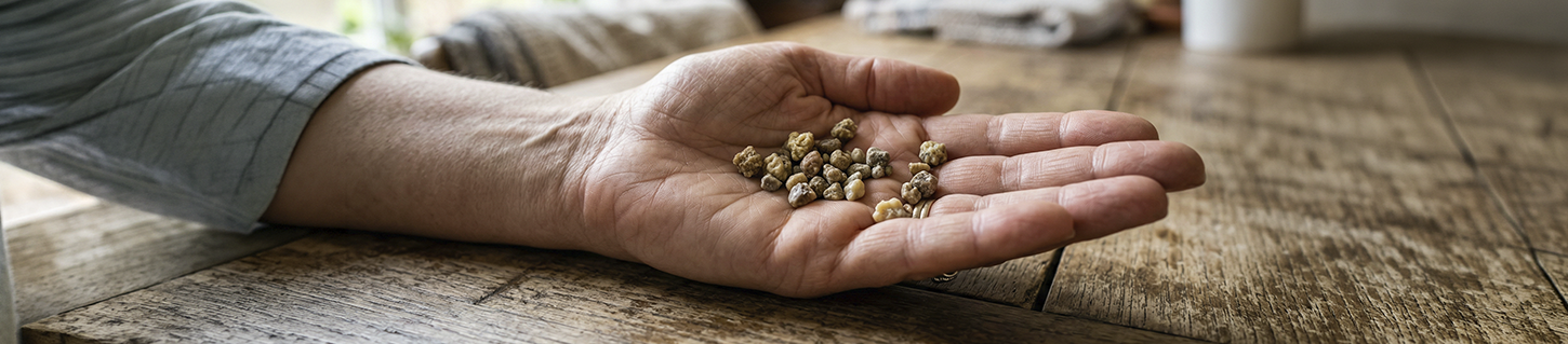 Errores comunes para prevenir cálculos renales 